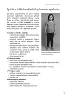 0107304699_9788088648604_zivot-s-downovy
