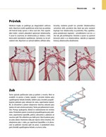 A101E0N0010846_Palickovani-Vlackova_list